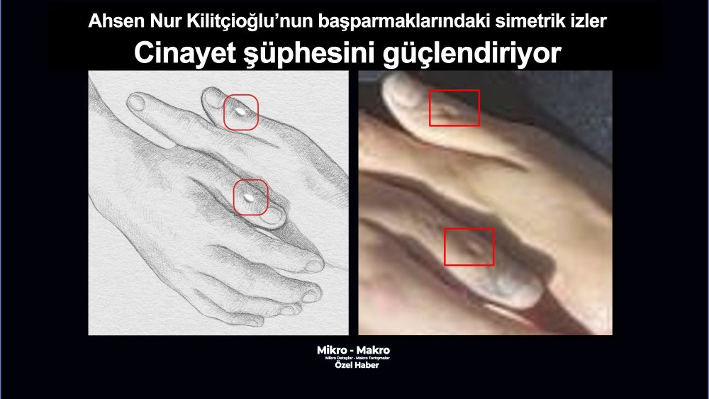 https://www.mikro-makro.net/ahsen-nur-kilitcioglunun-iki-basparmagindaki-simetrik-izler-cinayet-suphesini-guclendiriyor